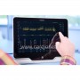 Moniteur PNI battement par battement Finapres® Nova