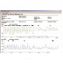 Logiciel nVision® gestion des données SpO2 Nonin®